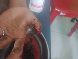 Kecelakaan kerja Di PT Hofmen, Seorang Karyawan Di Larikan Ke Rumah Sakit Nyaris Jari Tangan Putus